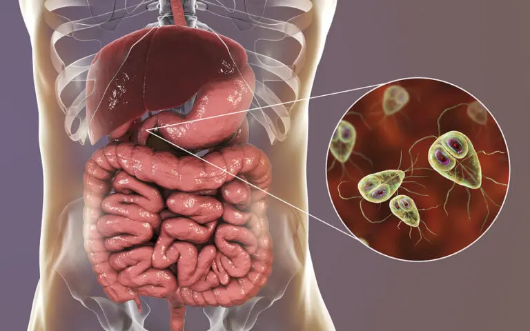 Giardiasis: síntomas y tratamiento