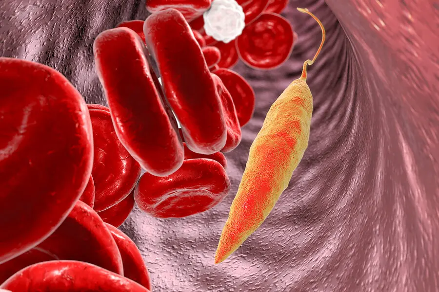 ¿Cómo se presenta la leishmaniasis?