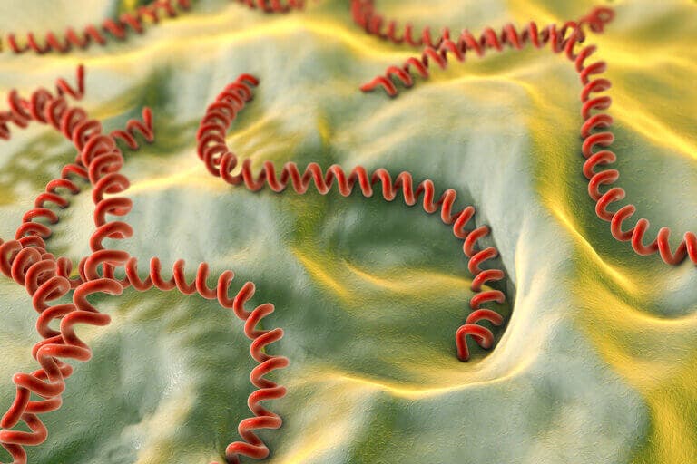 ¿Qué es la leptospirosis?