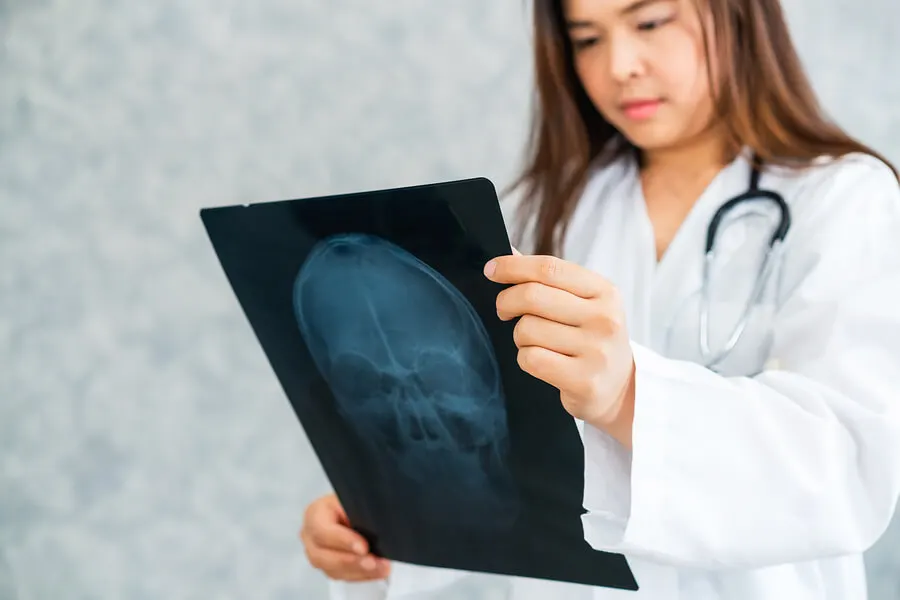 Alzheimer precoz: todo lo que debes saber