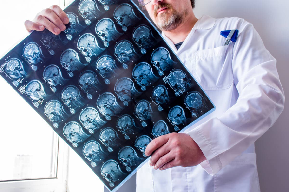 Tomografía computarizada cerebral.