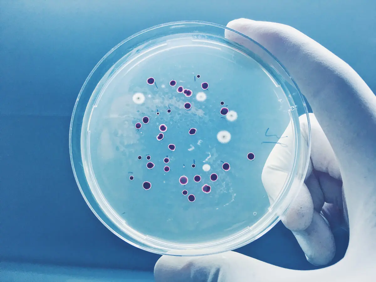 Placa de petri con cultivos de pitiriasis.