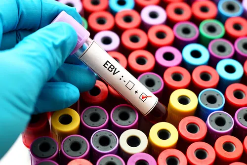 Prueba para el virus de Epstein Barr