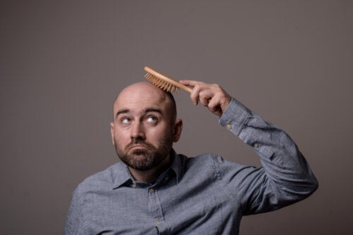 Tipos de alopecia
