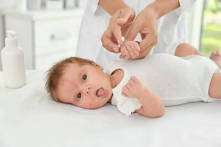Dermatitis atópica y seborreica, ¿cuál es la diferencia?
