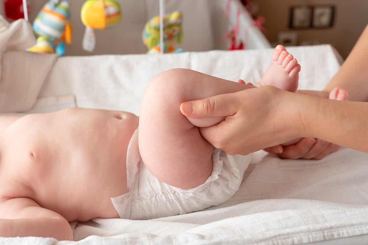 Dislocación congénita de cadera en el bebé