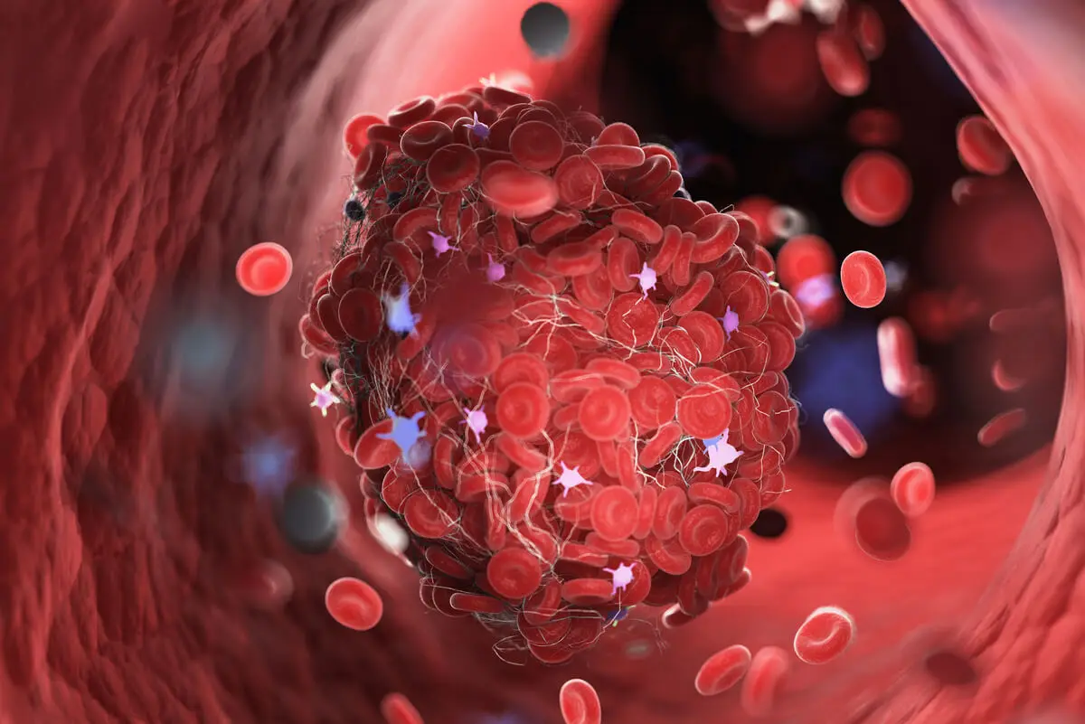 Tipos de hemofilia têm diferenças moleculares