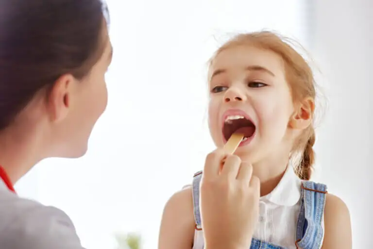 Diferencias entre amigdalitis vírica y bacteriana