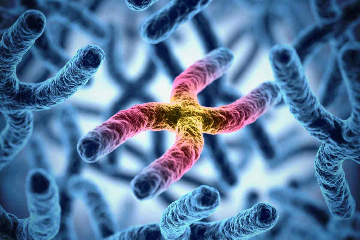 Cromosomas del síndrome de insensibilidad androgénica.