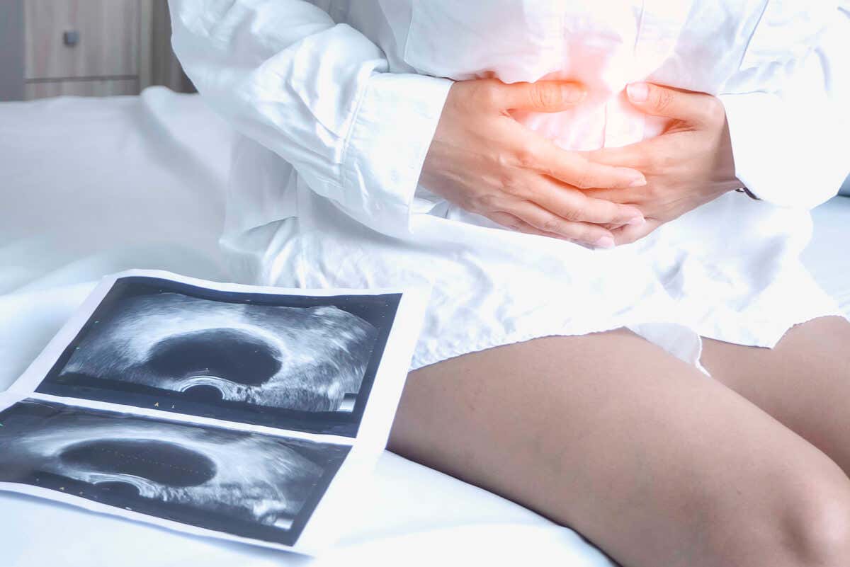 Detección de los quistes en los ovarios