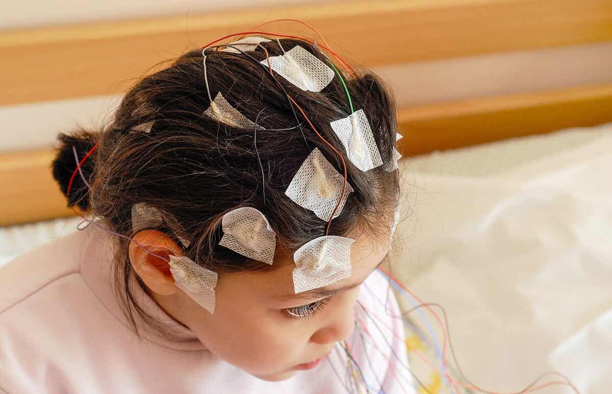 Électroencéphalogramme chez une fille.