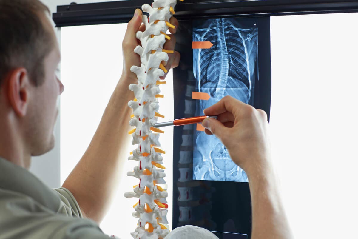 Medición de la columna vertebral para determinar escoliosis.