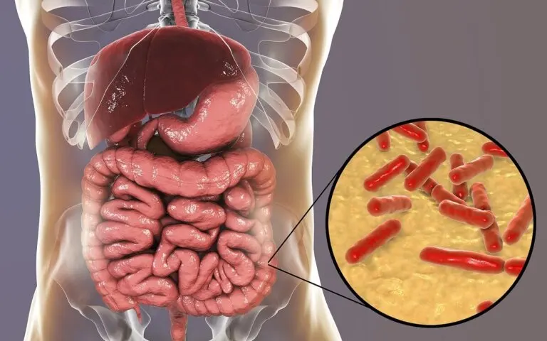 ¿Cómo saber si la flora intestinal está dañada?