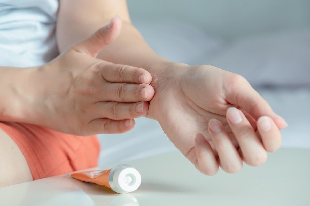 ¿Para qué sirve el gel de árnica?