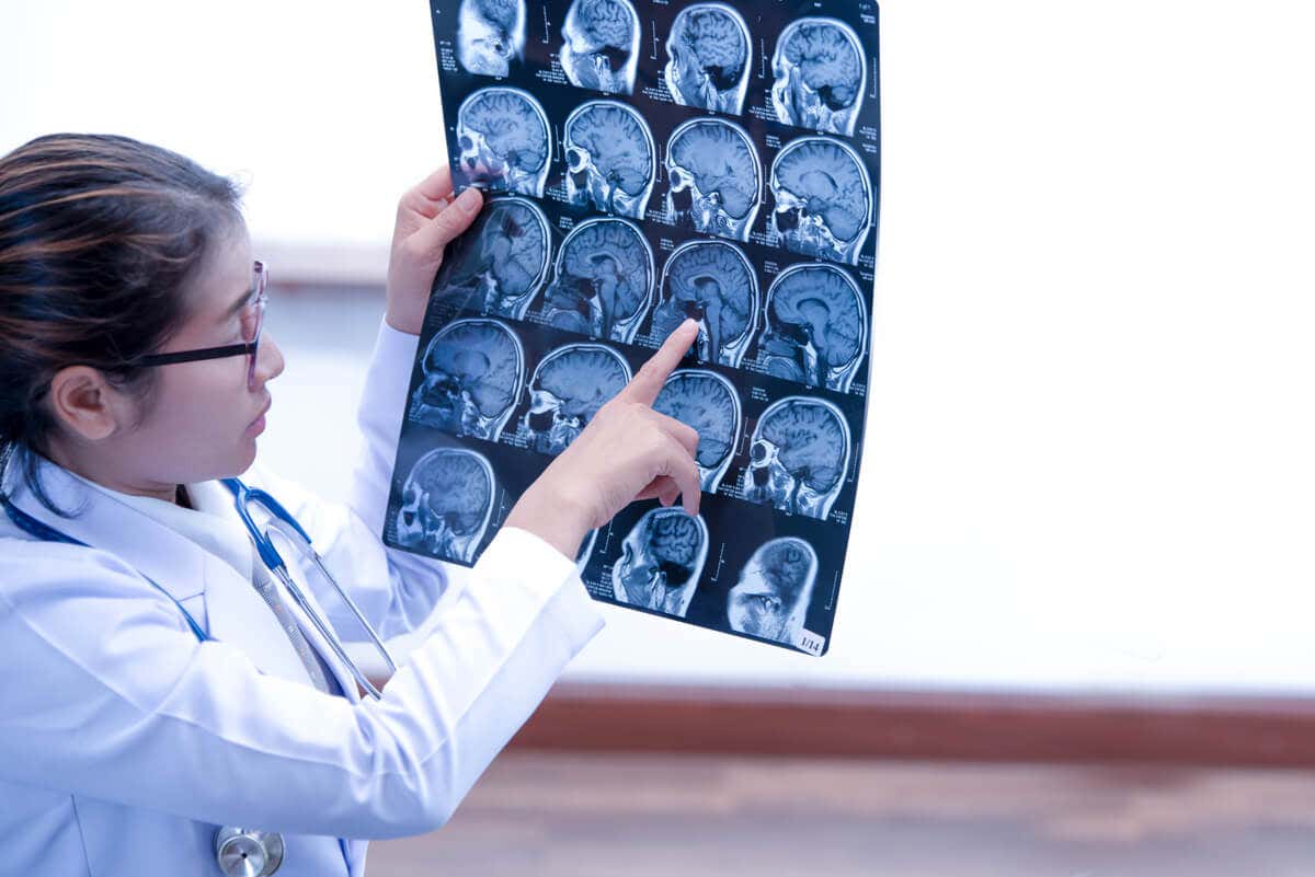 Médica revisa una tomografía cerebral