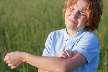 Fotoalergia y fototoxia: ¿en qué se diferencian?
