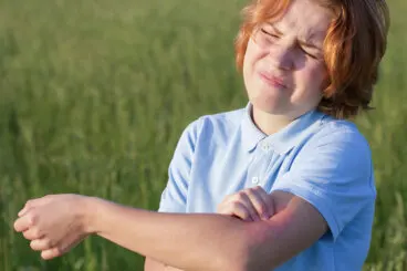 Fotoalergia y fototoxia: ¿en qué se diferencian?