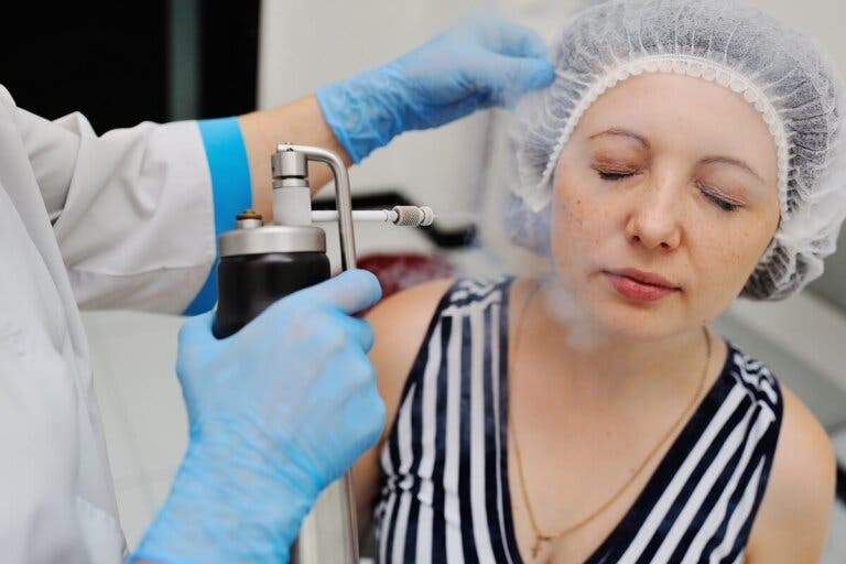 Criocirugía o crioterapia: ¿qué es y para qué sirve?