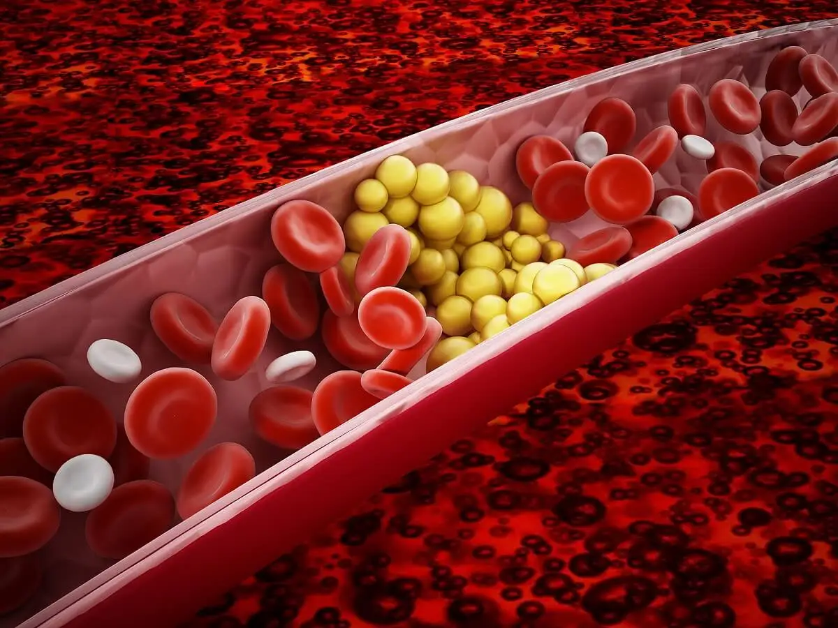 Wissenswertes über den Triglyceridspiegel