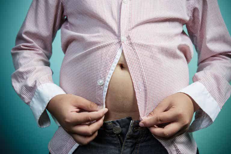 Obesidad causa dolor en las pantorrillas.