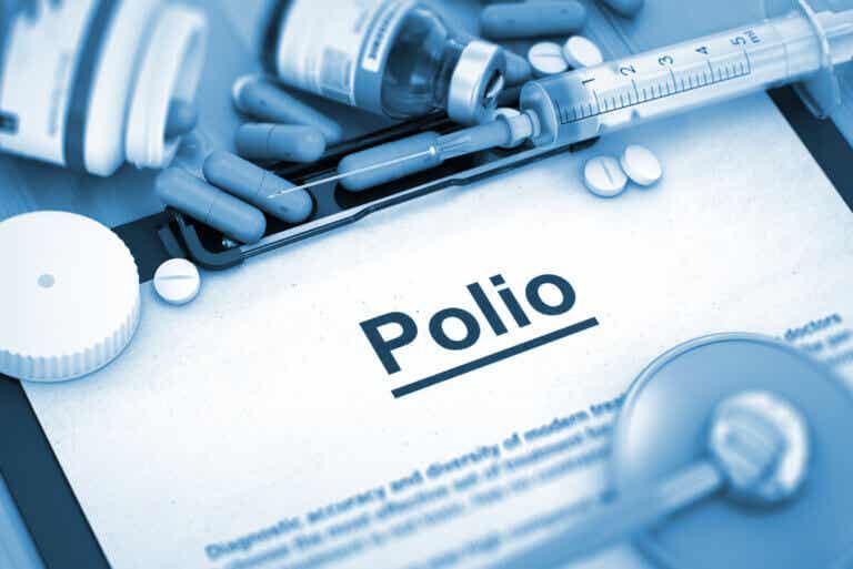 Tipos de poliomielitis