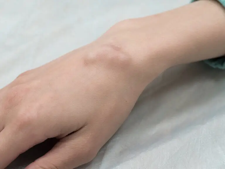 ¿Cuál es la diferencia entre un quiste y un tumor?