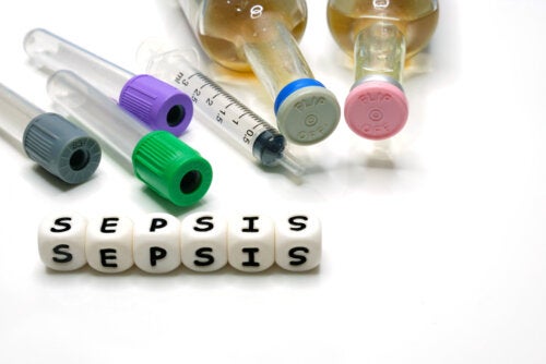 ¿Qué es la sepsis o septicemia?