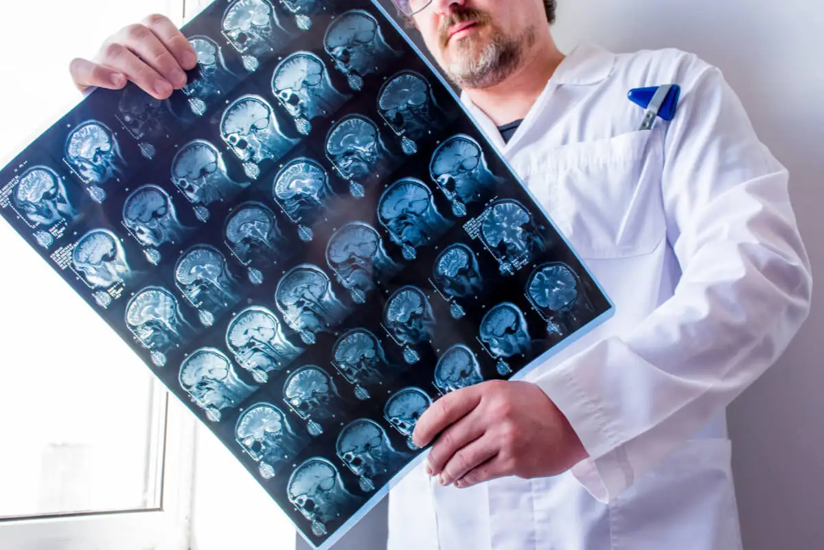 Diagnóstico de la epilepsia