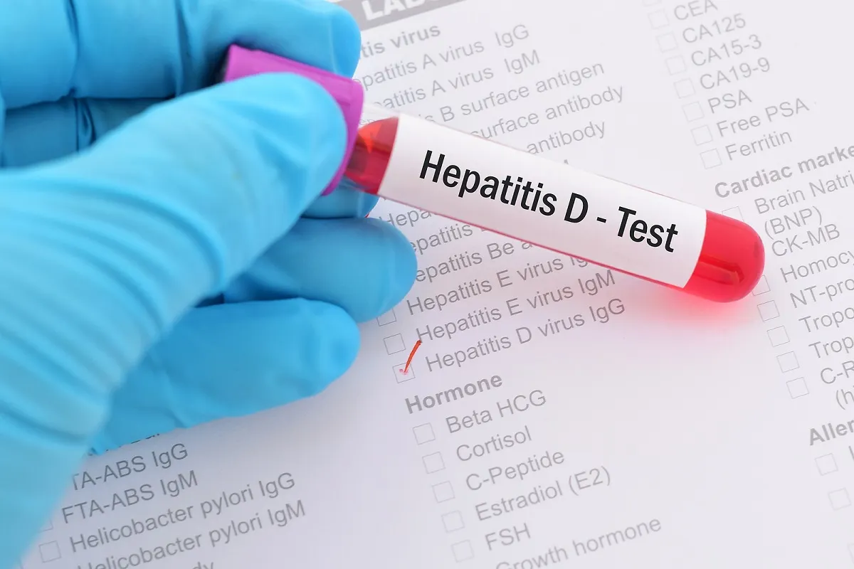 Hepatitis D