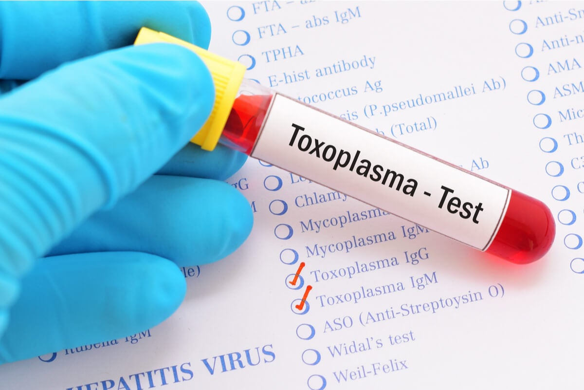 Test de toxoplasmosis