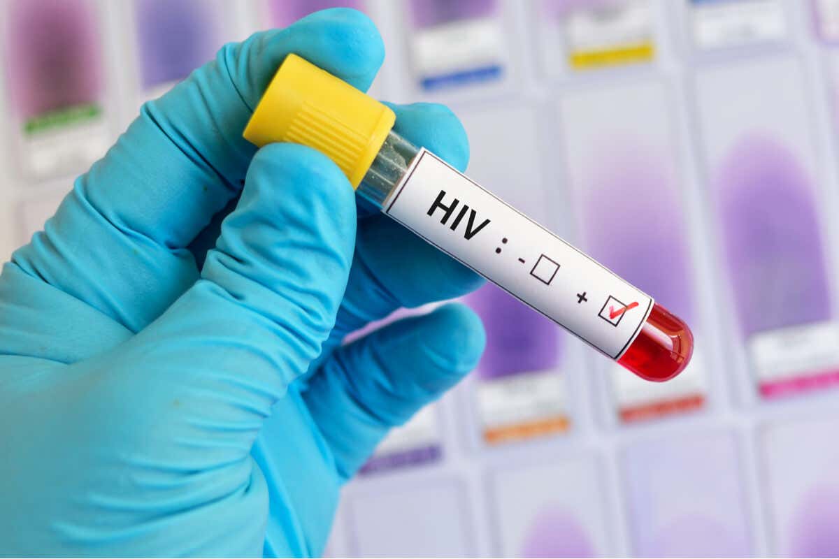 Etapas de la infección del VIH
