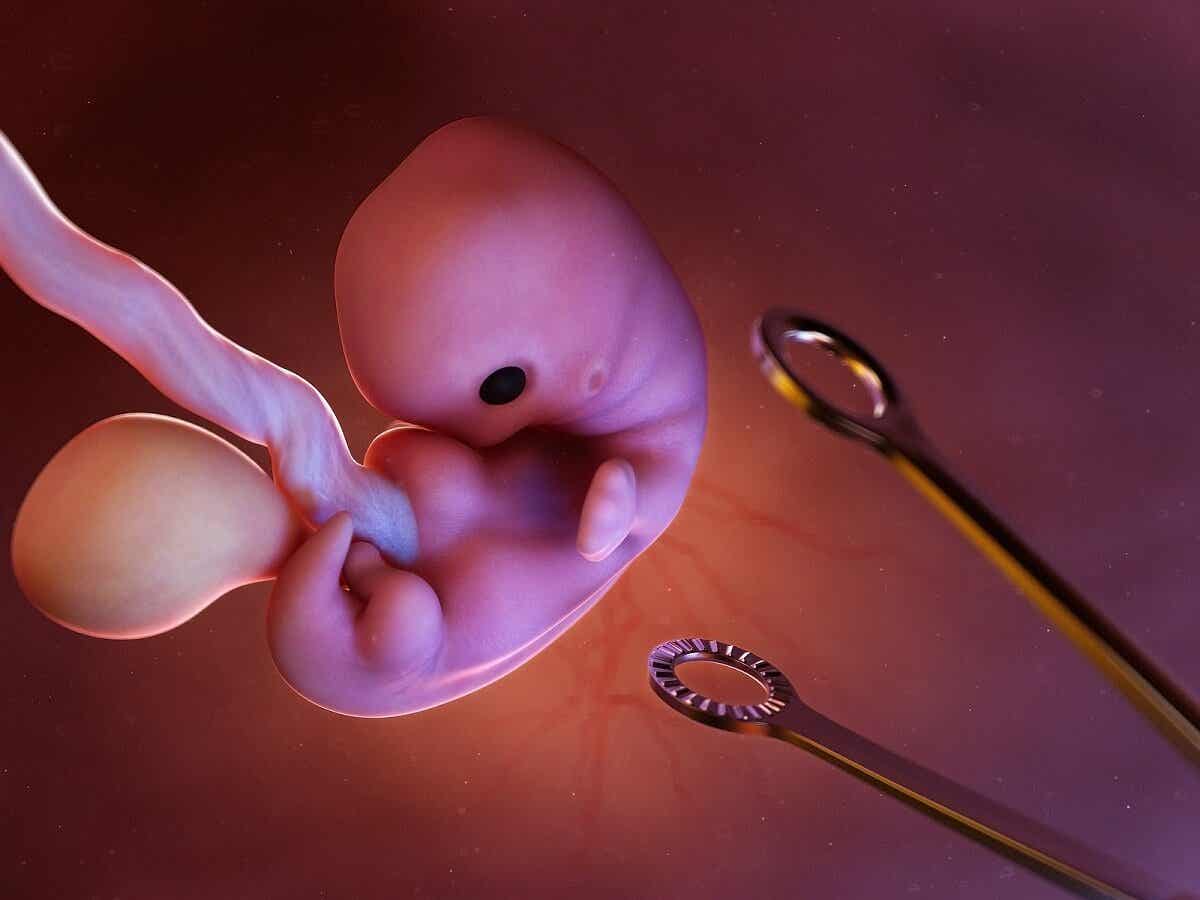 Aborto inducido: ¿en qué consiste?