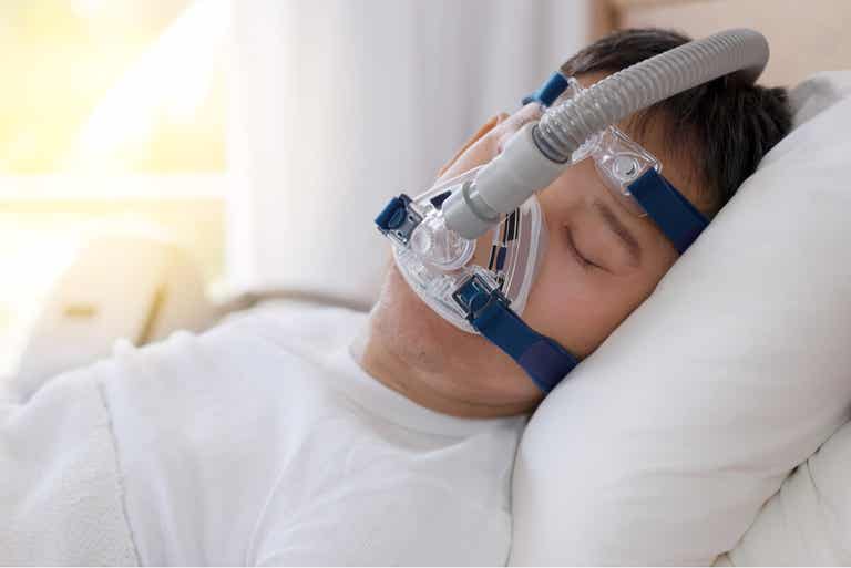 Apnea del sueño tratada con CPAP.
