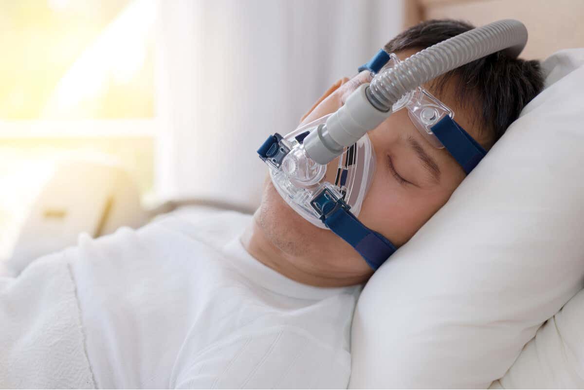 Apnea del sueño tratada con CPAP.