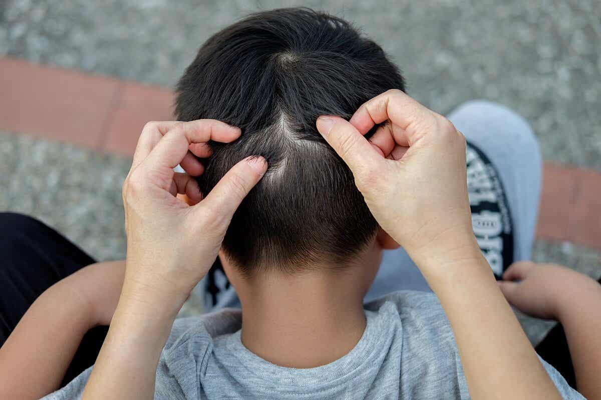 Alopecia en niños: ¿por qué se produce?