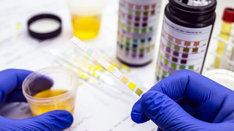 ¿Qué medicamentos cambian el color de la orina?