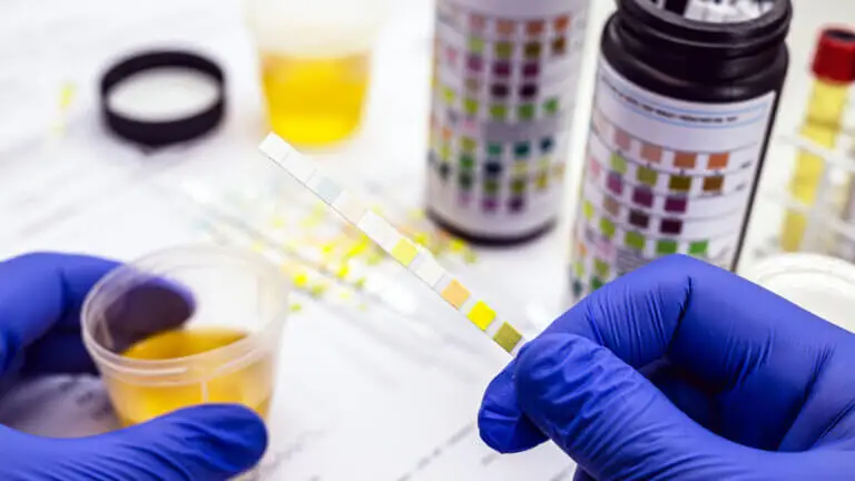 ¿Qué medicamentos cambian el color de la orina?