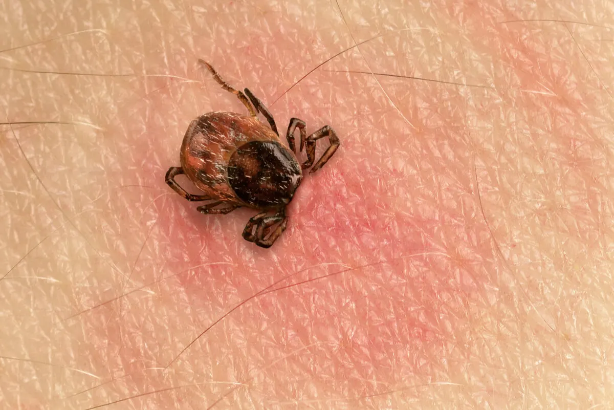 Garrapata pica la piel.