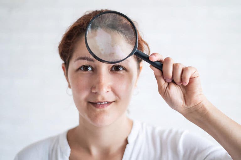 Manchas en la cara: causas, tipos y tratamientos