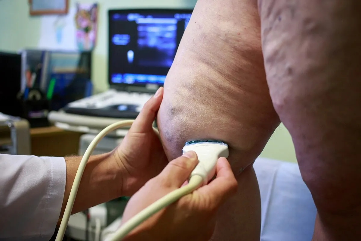 Diagnóstico de la paniculitis