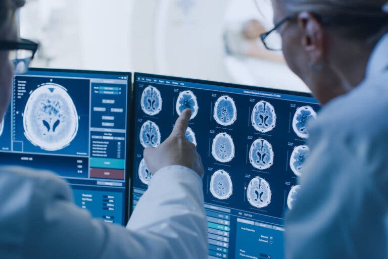 Meningioma: síntomas y causas