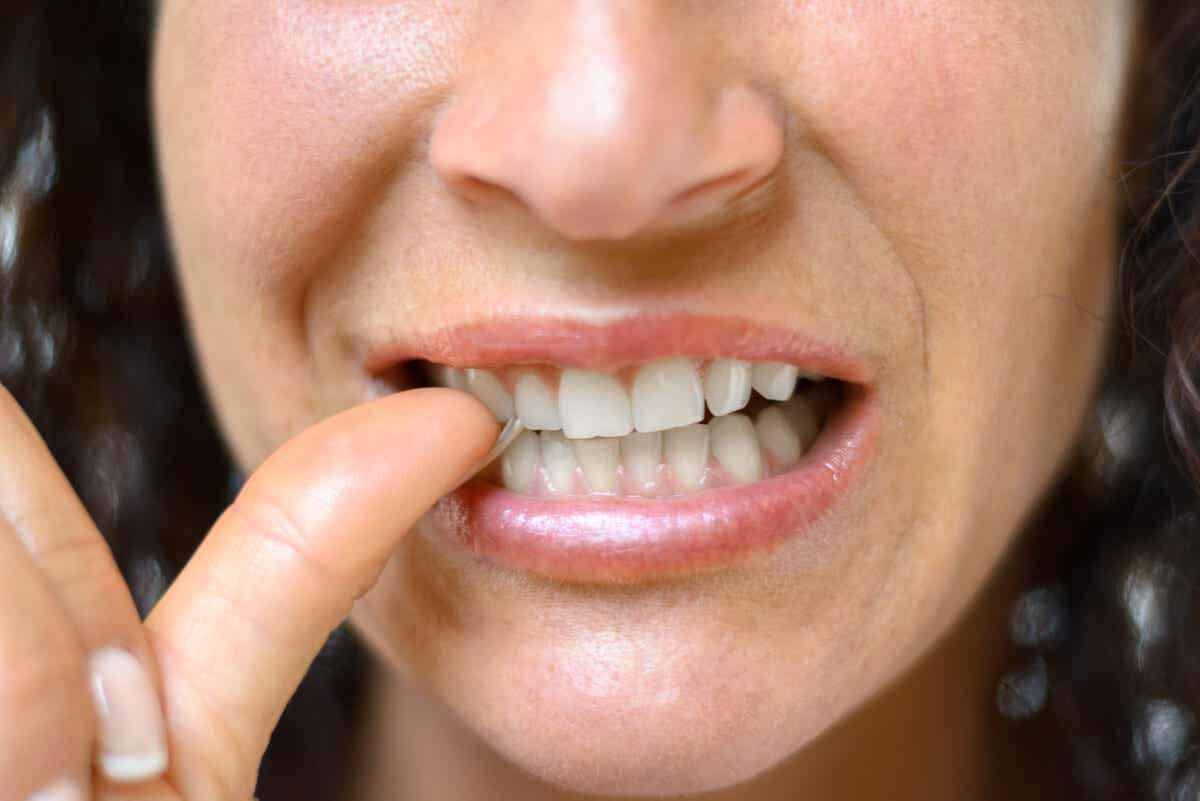Zahnfissuren - Frau kaut auf den Fingernägeln