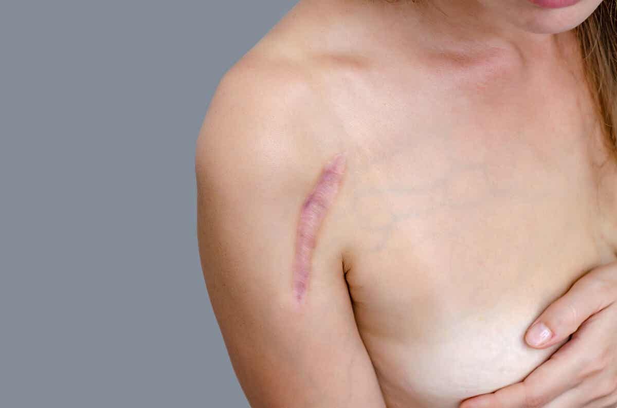 A woman with a scar.