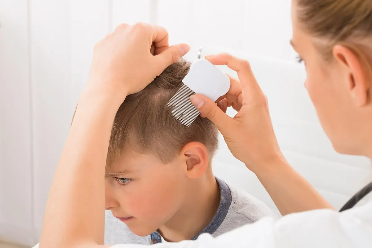 ¿En qué consiste la alopecia en niños?