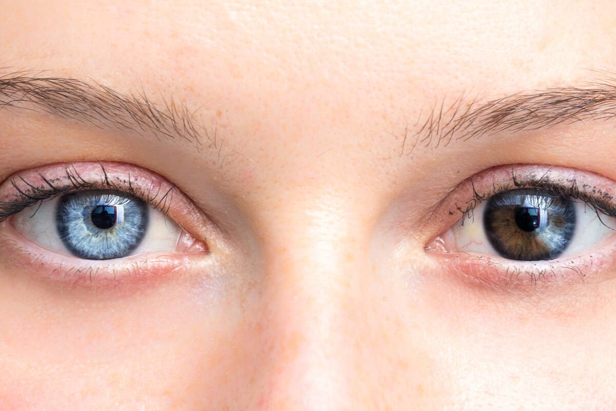 Cambios en el color de los ojos.