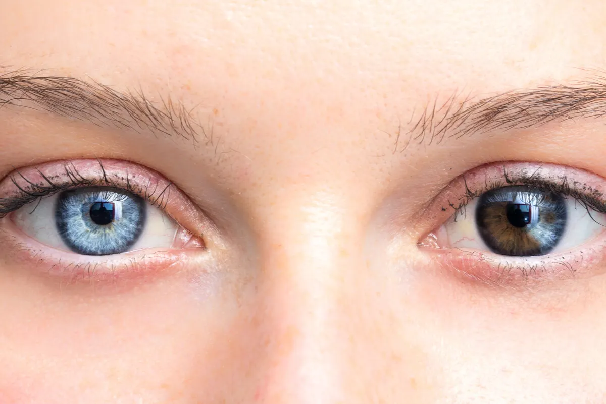 Cambios en el color de los ojos.