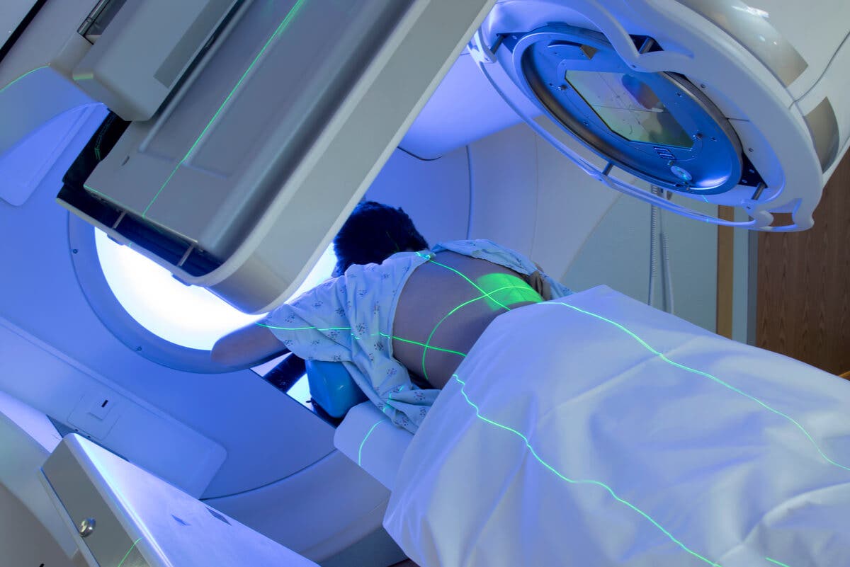 Radioterapia oncológica.