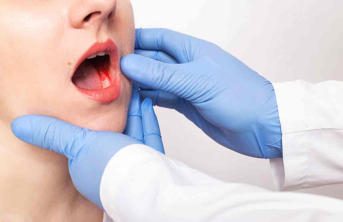 Síntomas y causas de la periodontitis