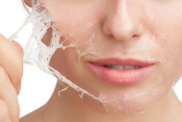 Epidermólisis bullosa o piel de cristal: síntomas y causas