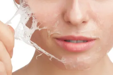 Epidermólisis bullosa o piel de cristal: síntomas y causas